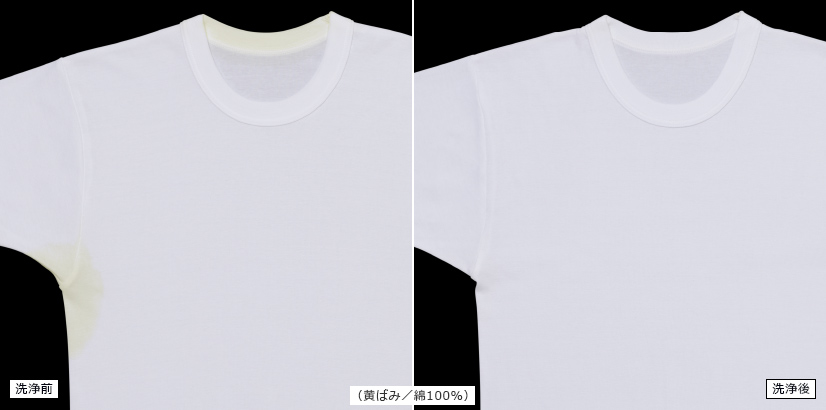 （肌着の黄ばみ／綿100%）