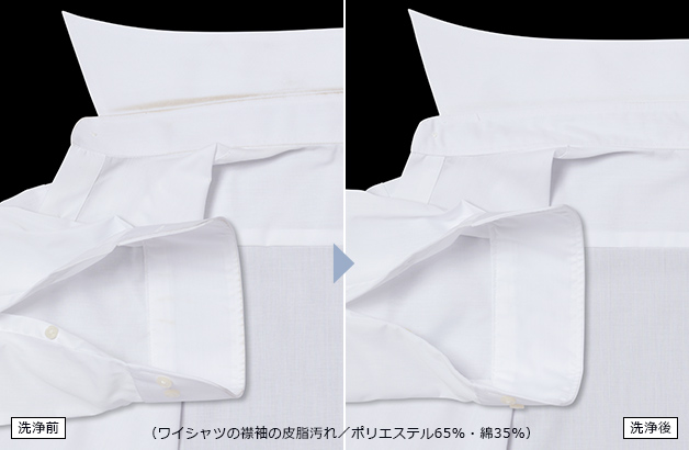 （ワイシャツの襟袖汚れ／ポリエステル65%・綿35%）